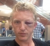 gözü şişmiş dirk kuyt korkunçluğu / #484223