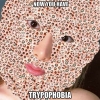trypophobia